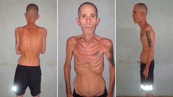 Las impactantes imágenes de un preso político cubano al salir de prisión luego de cinco años tras las rejas