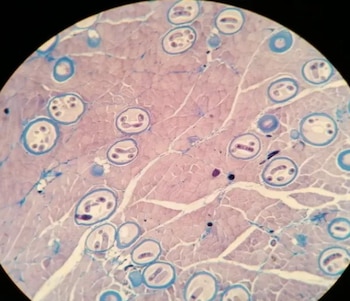 Las larvas del parásito Trichinella pueden alojarse en el tejido muscular de animales infectados