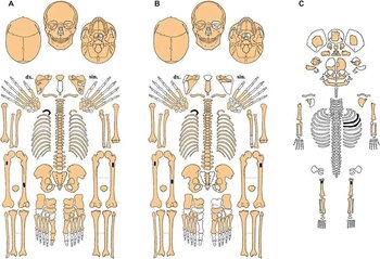 Ambos esqueletos presentan signos de