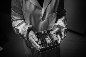 Muestras de coronavirus para ser