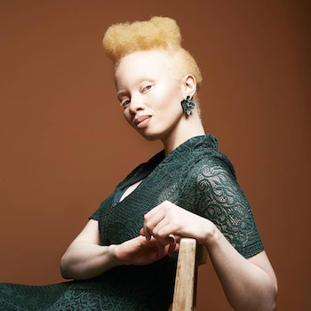 Thando Hopa nació en Sudáfrica,