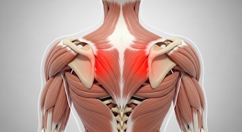 Ilustración 3D de la espalda superior de una persona, mostrando músculos, omóplatos y vértebras, con dos puntos rojos que señalan dolor cerca del trapecio.