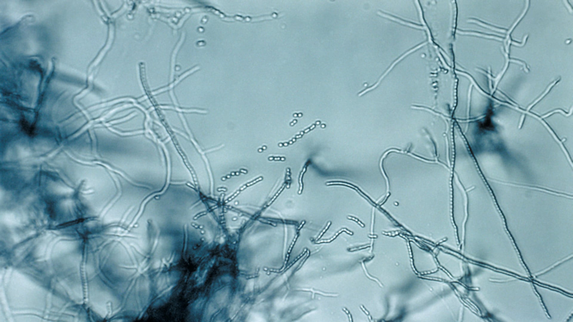 La bacteria del suelo Streptomyces produce una toxina que mata insectos con una precisión nunca antes documentada en ese género/ CDC
