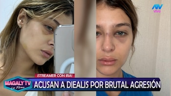 Streamer Diealis reconoce problema con el alcohol tras denuncia de su expareja. Captura: Magaly Tv La Firme.