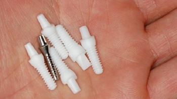 Las prótesis provisorias no se adaptaron correctamente y provocaron molestias, dificultades para alimentarse y cambios en la apariencia facial de la paciente. (Foto de archivo)