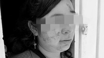 defensa propia mujer teresa cdmx