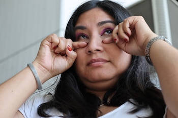 Existen distintos tipos de conjuntivitis.