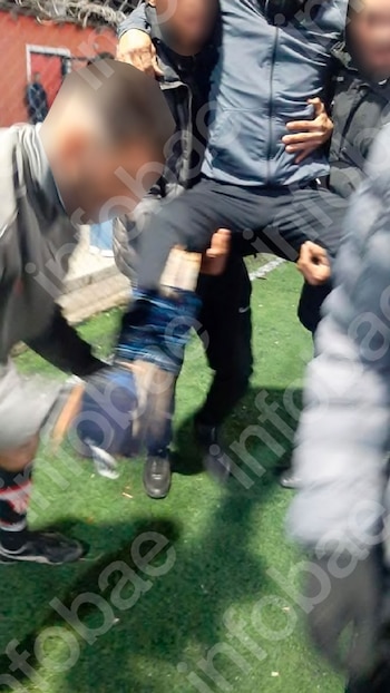 Tropezó con una alfombra rota mientras jugaba al fútbol 5, se fracturó tibia y peroné y le pagarán $31 millones
Redacción: Infobae Argentina
