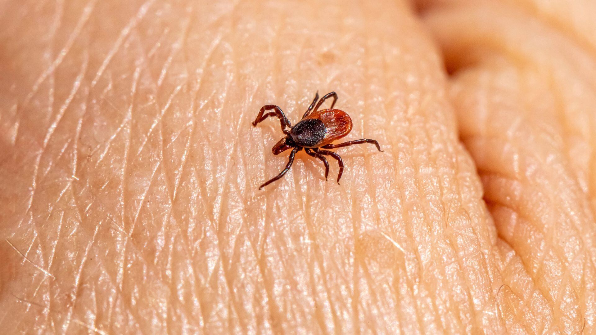 La enfermedad de Lyme está provocada por un tipo de garrapata (Canva)