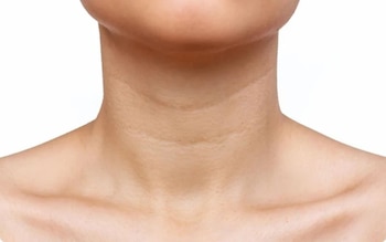 El cuello es la zona