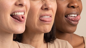 Primer plano de las bocas de tres personas con diferentes tonos de piel, una dobla la lengua en U, otra no puede y otra lo intenta.