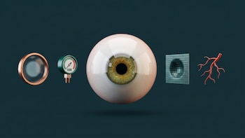 Los cuatro cuadros oculares más habituales por la edad y cómo prevenirlos