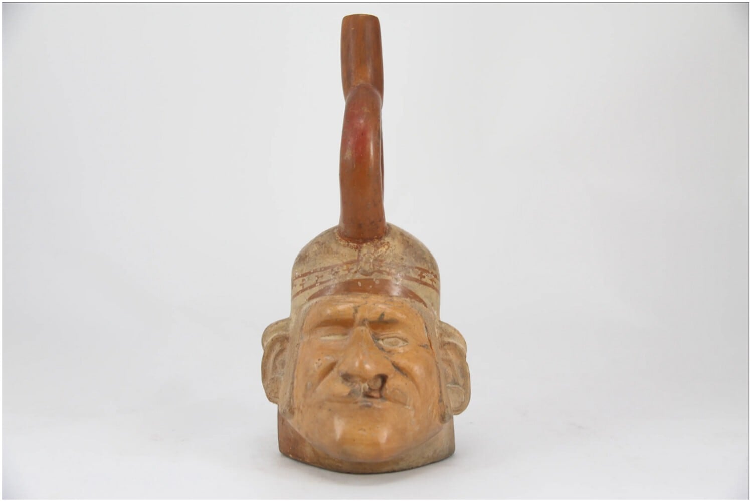 Solo seis casos de labio hendido han sido identificados en restos arqueológicos andinos debido a la fragilidad ósea y la escasa preservación - Scaffidi, BK (2025). ¿Celebrando el labio leporino? Evidencia osteológica y artística de la deformidad labial en un individuo con cabeza de trofeo del sur del Perú. Ñawpa Pacha , 1–25. https://doi.org/10.1080/00776297.2025.2565062