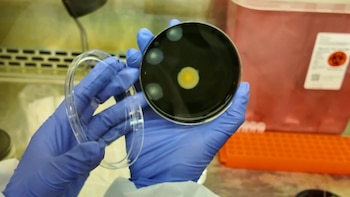 Un par de manos con guantes azules sostiene una placa de Petri abierta con medio de cultivo oscuro y varias colonias visibles