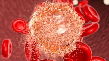 Se trata de un síntoma