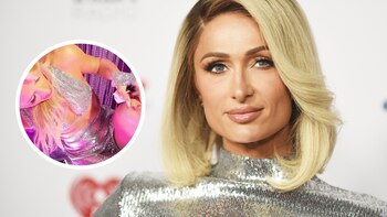 Paris Hilton muestra su herida