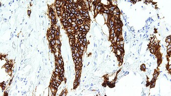La expresión de la proteína
