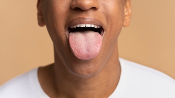 Síntomas tempranos de la anemia