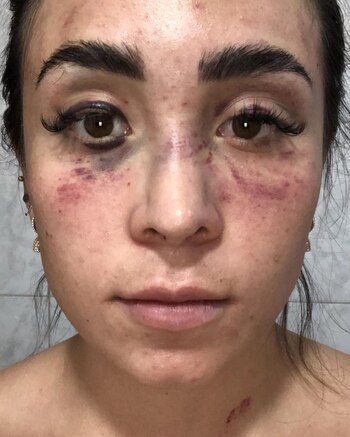 Kenya Mirelle compartió las fotos