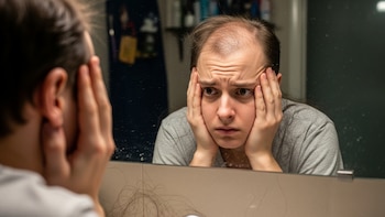Científicos hallan un azúcar natural que mostró resultados prometedores frente a la caída del cabello