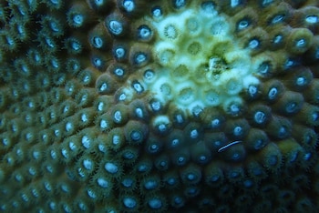 La enfermedad de pérdida de