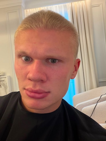 El delantero del Manchester City se cortó el pelo y se lo mostró a sus amigos
