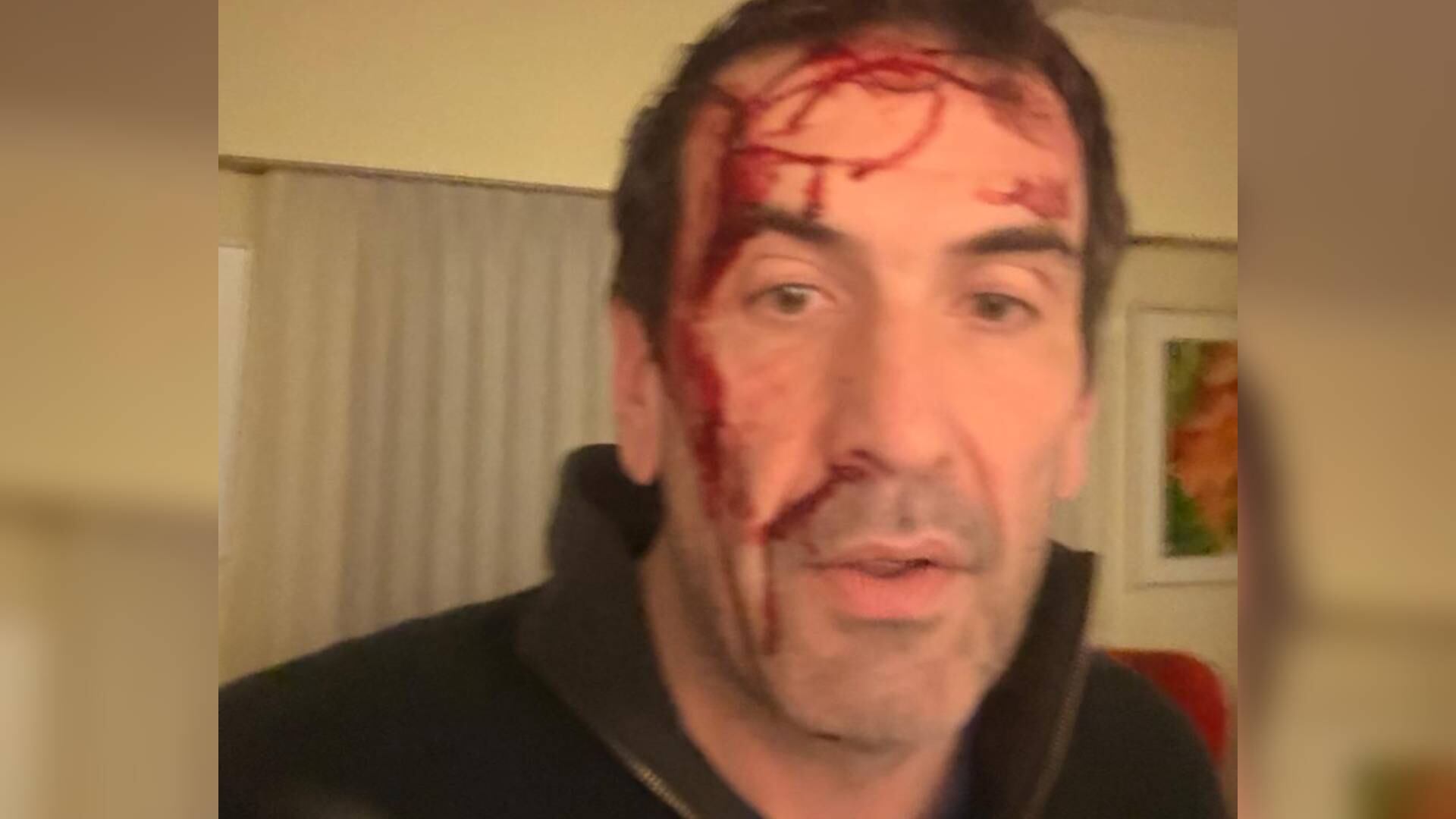 Qué se sabe sobre el violento robo al diputado y senador electo Pablo Cervi