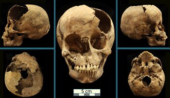 Entierro 189. Cráneo (diferentes tomas).