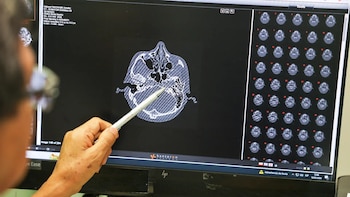 El riesgo de daño auditivo