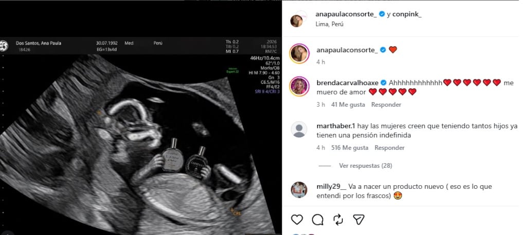 Ana Paula Consorte compartió una ecografía en Instagram en una publicación vinculada a su marca de perfumes. IG