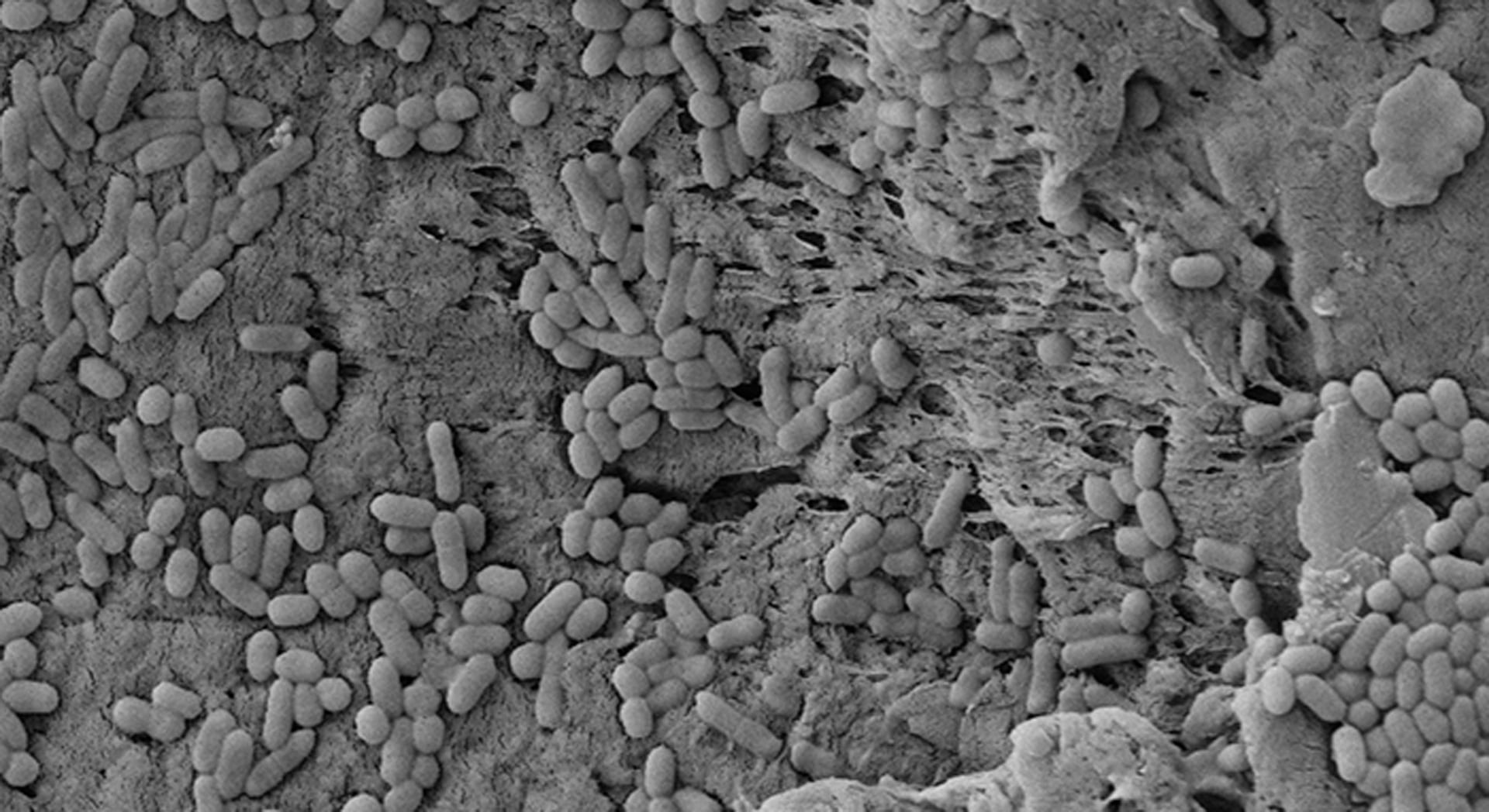 La bacteria Listeria monocytogenes provoca complicaciones severas como abortos espontáneos y partos prematuros en mujeres embarazadas