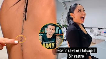 Pamela Franco voltea la página y se borra tatuaje en nombre de Christian Domínguez. (Composición: Infobae)