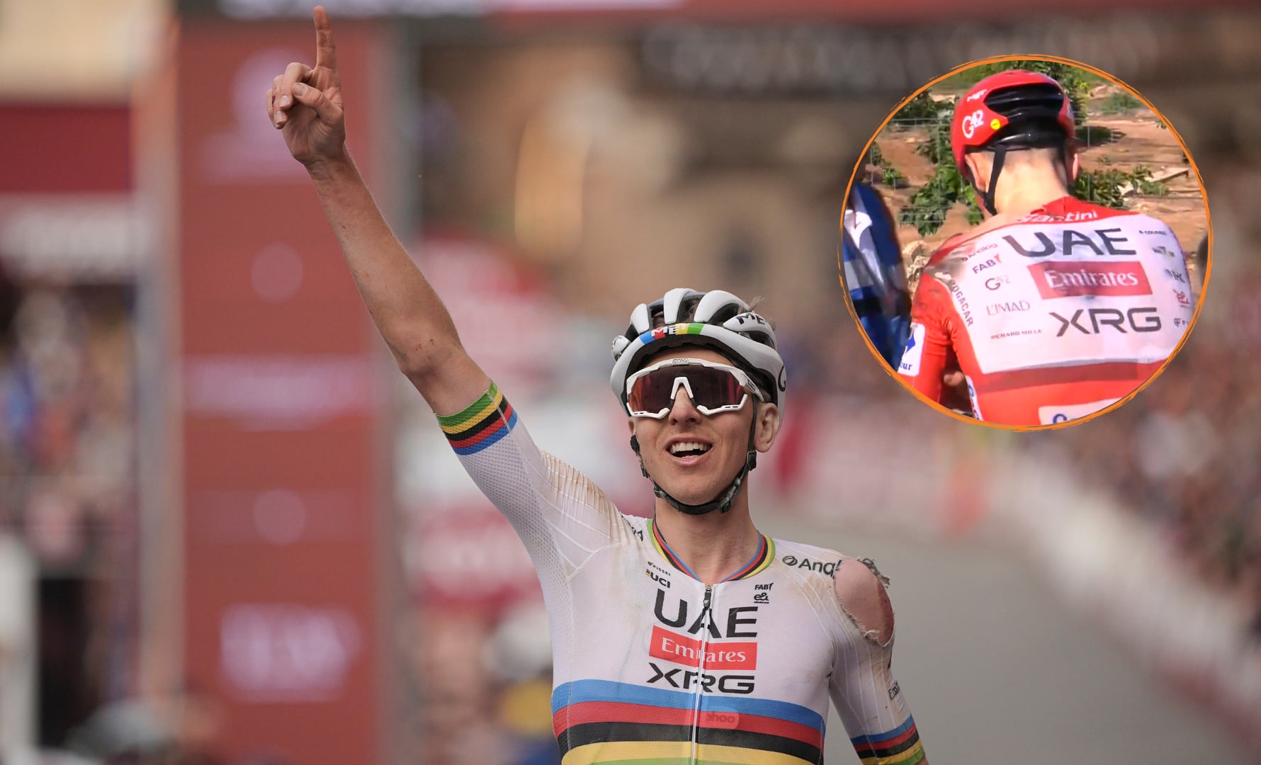 El líder del UAE Team Emirates sufrió una conmoción cerebral y fracturas en la clavícula izquierda y la vértebra cervical C7, parte médico que lo mantendrá bajo observación. (Especial)