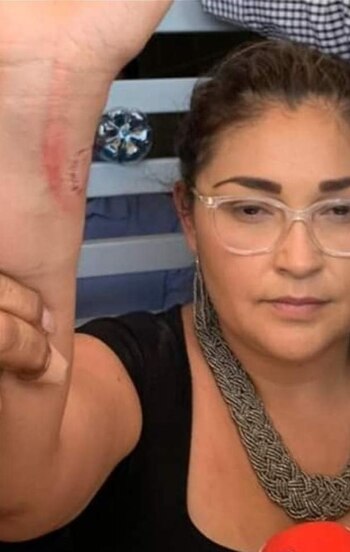 A mordidas se atacan dos