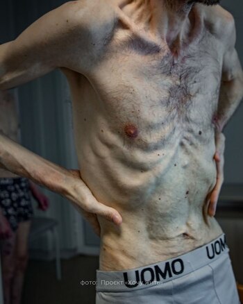 Las imágenes mostraban el deterioro