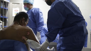 La dependencia alertó por quemaduras