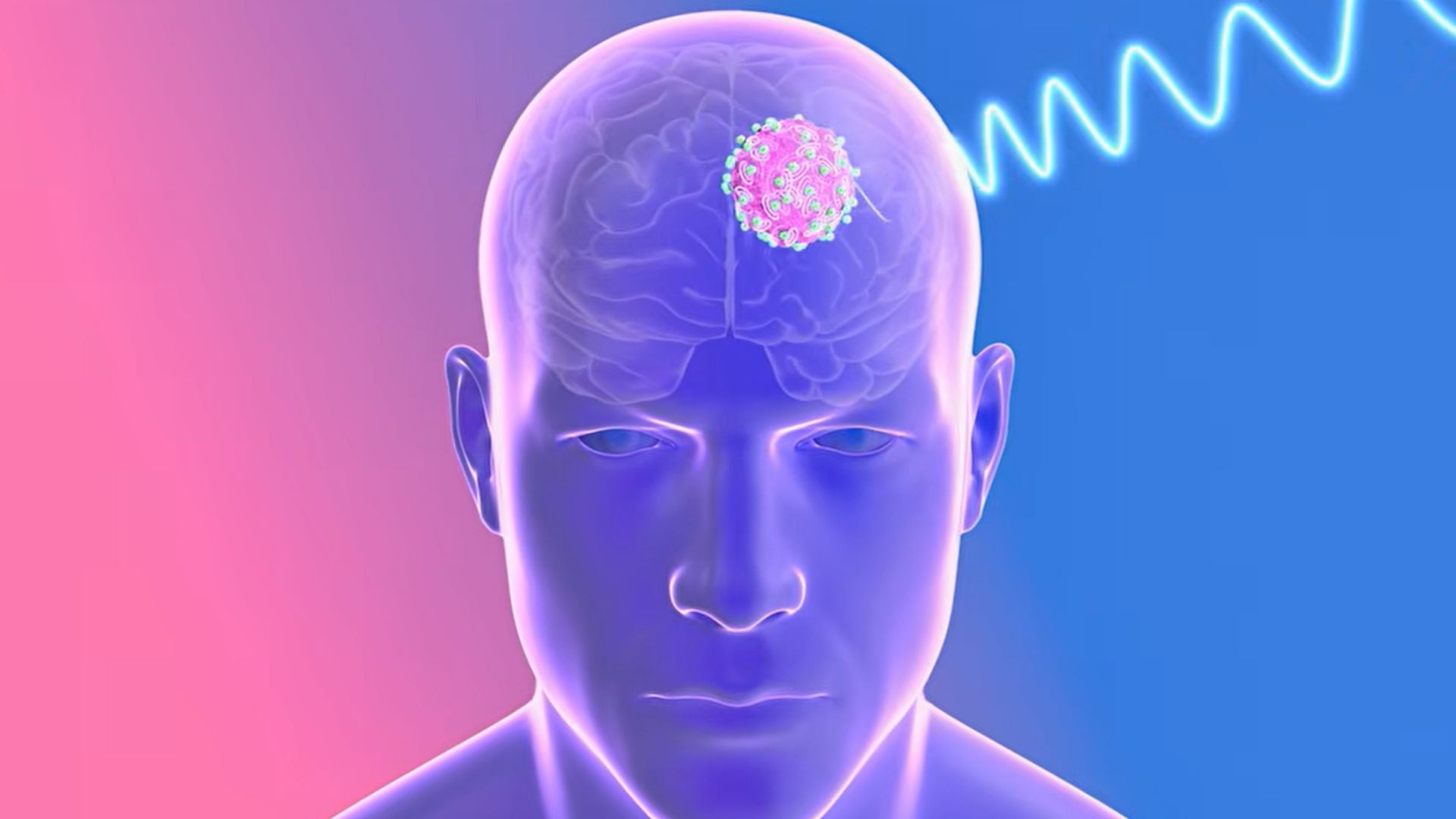 La activación inalámbrica con un campo magnético de baja frecuencia atraviesa el cráneo sin generar calor dañino y desencadena el efecto antitumoral (Yt: @MIT Media Lab)