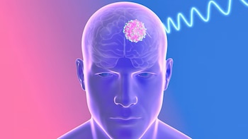 Ilustración digital de una cabeza humana traslúcida con un cerebro visible, un tumor esférico rosado y una onda brillante azul en el lateral