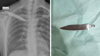 Esta es la radiografía y