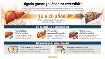 Infografía detallada sobre el hígado graso, mostrando su progresión desde un estado reversible hasta la cirrosis irreversible, con un esquema de tiempo.