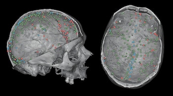 Dos vistas de un cráneo humano 3D gris, una de perfil cortado y otra superior, con cientos de pequeños puntos rojos, verdes y azules marcando la superficie interior