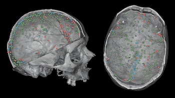 Descubren una red oculta en el cráneo que podría participar en la defensa del cerebro: cómo funciona