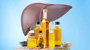 ¿Cuál es el mejor aceite