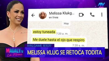 Melissa Klug revela sus cirugías: