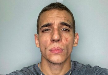 El actor español Miguel Herrán