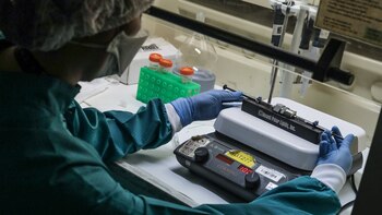 Estos son los 10 procedimientos