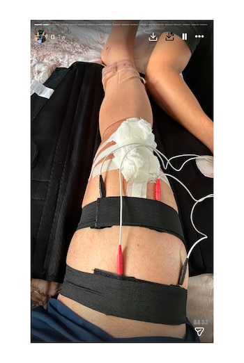 Recibió tratamiento de rehabilitación con