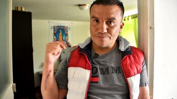 Reconstrucción de manos en Bogotá