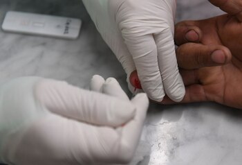 El test consiste en la