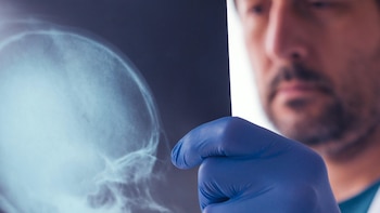 Qué es la “negligencia espacial”,